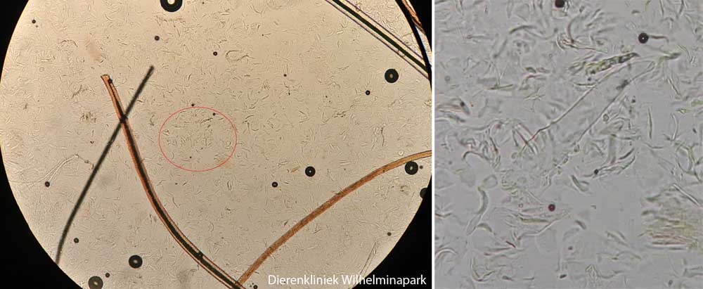 Demodex mijt onder de microscoop